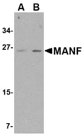 IHC-plus™ MANF / ARMET Antibody