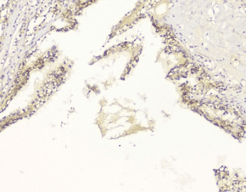 APP / Beta Amyloid Precursor Antibody