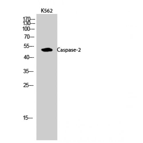 CASP2 / Caspase 2 Antibody (100-180 aa)