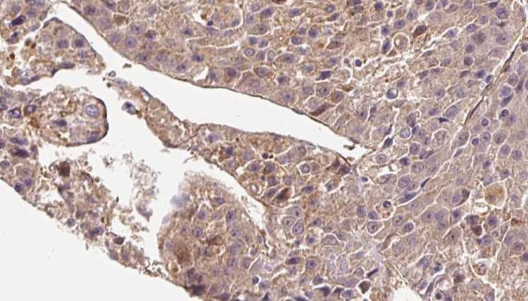 SLC4A7 Antibody