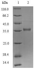 Pseudomonas aeruginosa Protease LasA Protein (Recombinant 6His-SUMO, N-terminus)