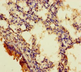 Polyclonal Rabbit anti-Human RGMA Antibody