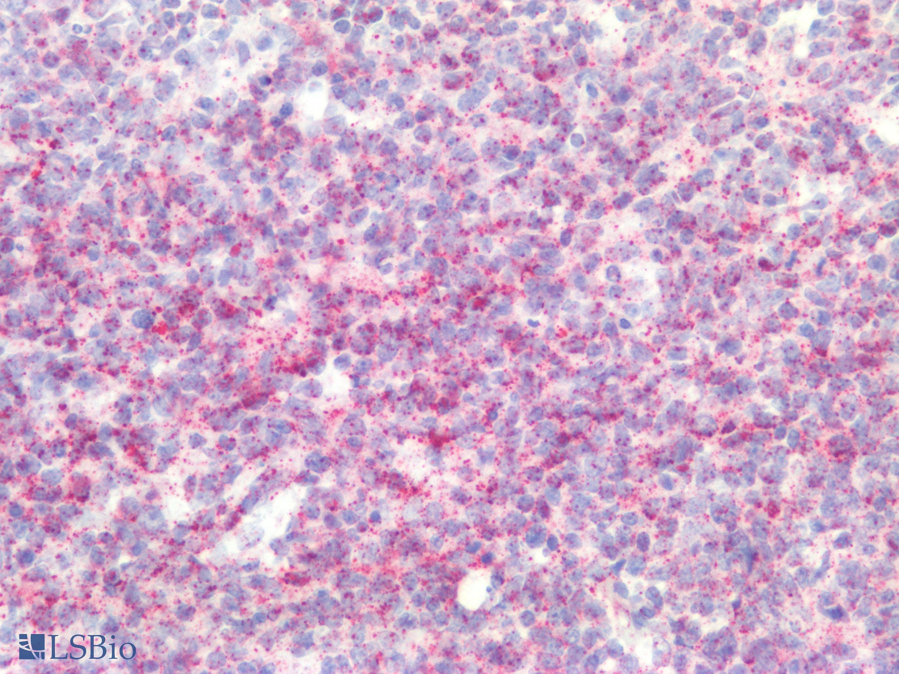 PathPlus™ IL17A Antibody
