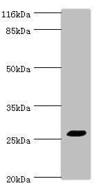 Polyclonal Rabbit anti-Human TREM1 Antibody (aa21-205, WB)