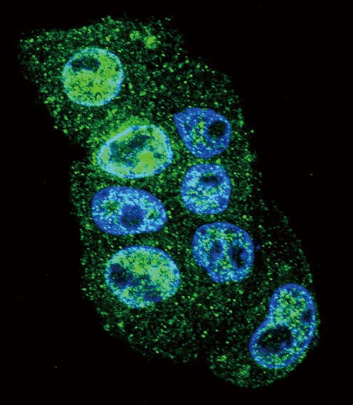 INHBA / Inhibin Beta A Antibody (aa85-112)