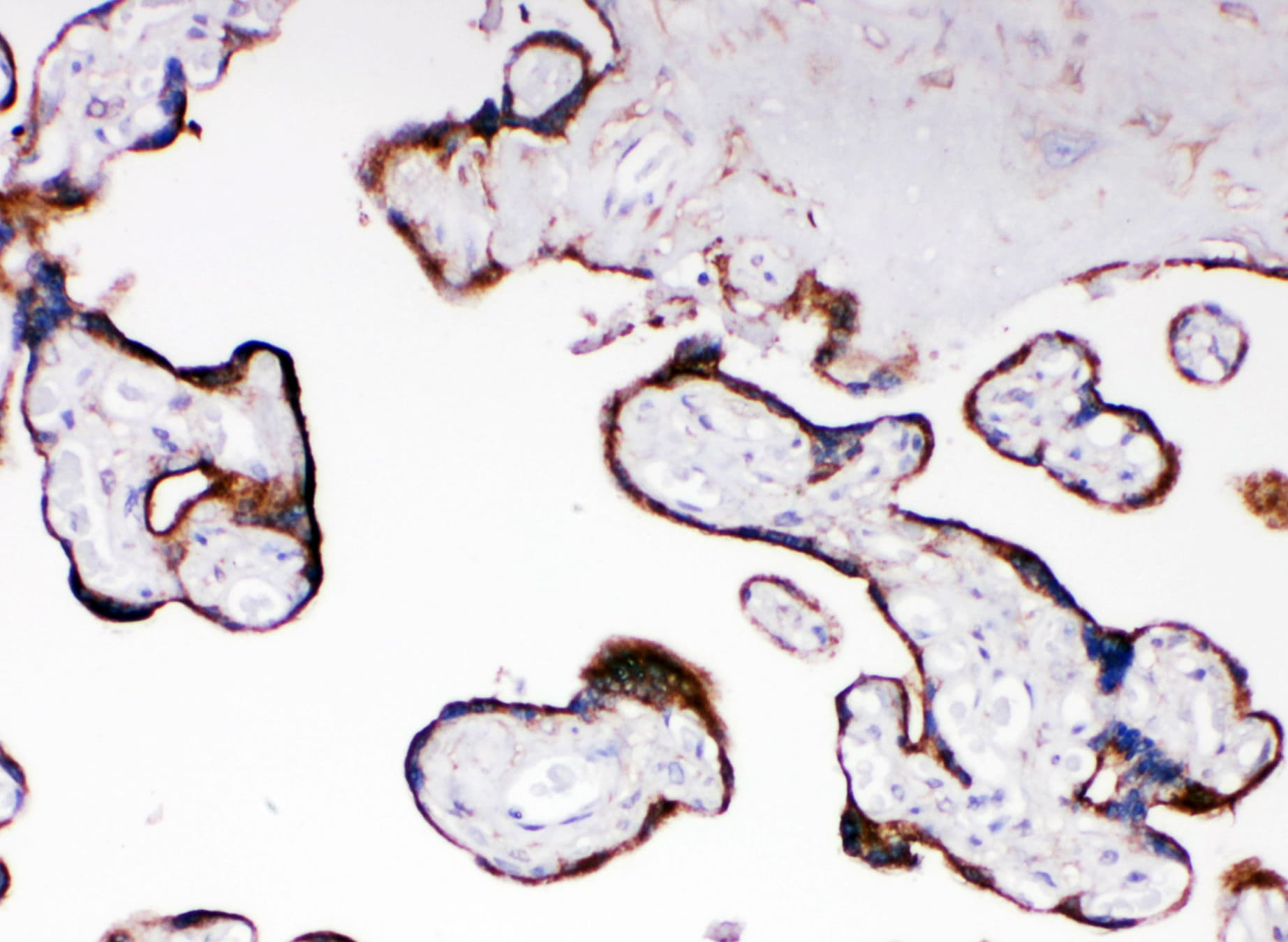 Polyclonal Rabbit anti-Human CYPOR / POR Antibody (aa659-677, IHC, WB)