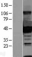 CTBP1 / CTBP Protein (Over-Expression Lysate Myc-DDK (Flag))