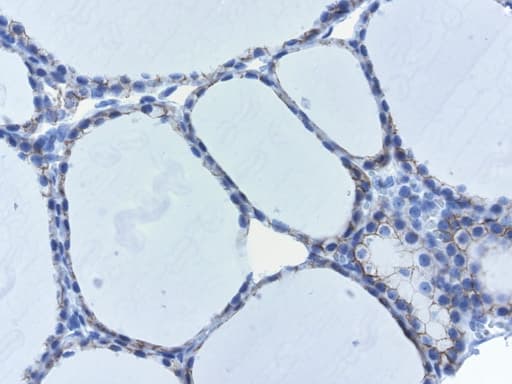 CDH1 / E Cadherin Antibody (clone UMAB184)