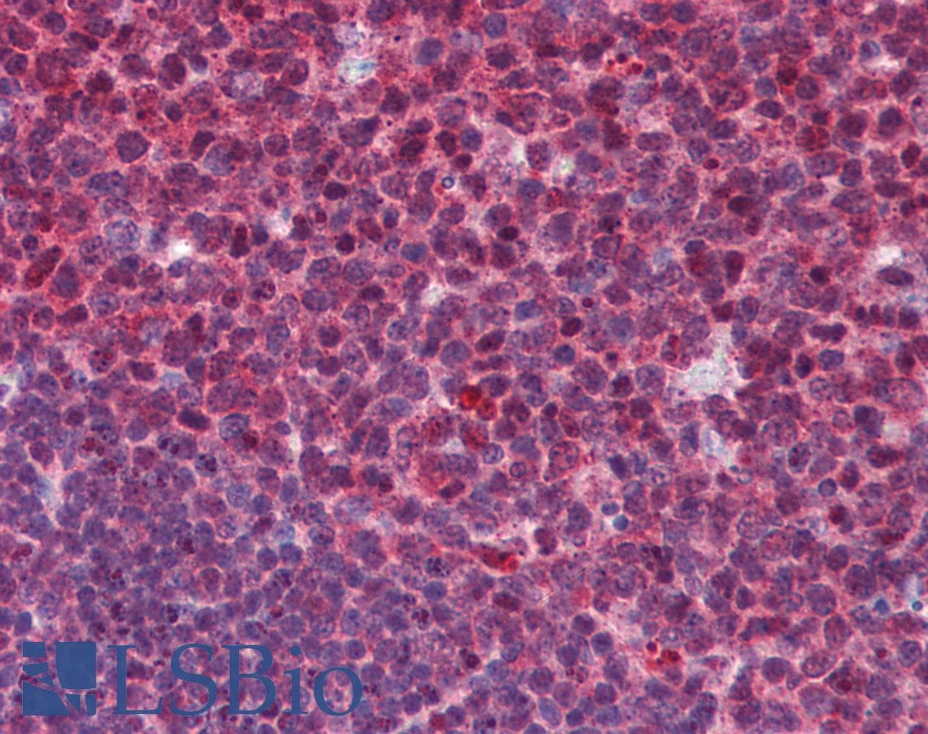SENP1 Antibody (C-Terminus)
