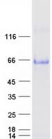 Human MICA Protein (Recombinant Myc-DDK (Flag))
