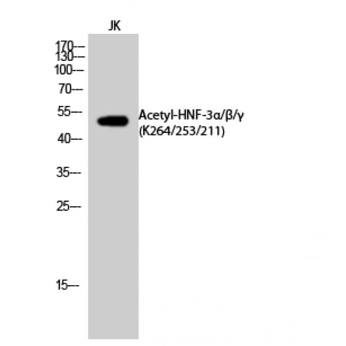 Polyclonal Rabbit anti-Human FOXA1 + FOXA2 + FOXA3 Antibody (acetylation site of K264/253/211., WB)