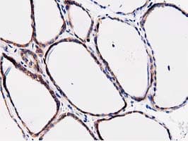 FAM40A Antibody (clone OTI7B8)