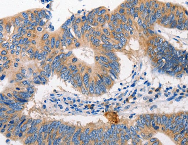 Polyclonal Rabbit anti-Human MTOR Antibody (IHC)