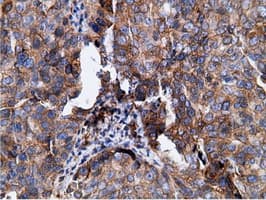 KHK / Ketohexokinase Antibody (clone OTI3D1)