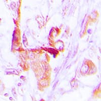 Polyclonal Rabbit anti-Human EEF2 / Elongation Factor 2 Antibody (N-Terminus, IHC, IF, WB)
