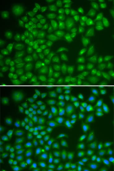 IHC-plus™ RAB4A / RAB4 Antibody