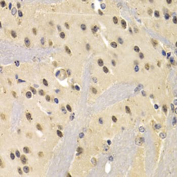 NUDT6 Antibody