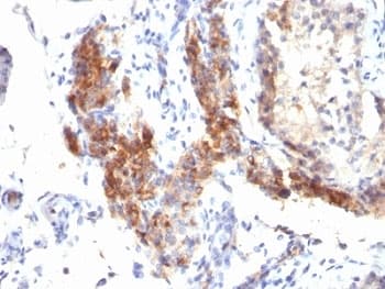 FOXP3 Antibody (clone SPM579)