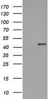 HAO1 Antibody (clone OTI5F4)