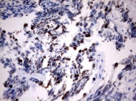 MKI67 / Ki67 Antibody (aa1160-1493, clone OTI5D5)