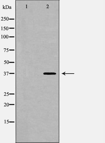 Polyclonal Rabbit anti-Human POLB / DNA Polymerase Beta Antibody (IHC, IF, WB)