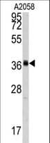Polyclonal Rabbit anti-Human POLR1C / RPA39 Antibody (aa319-346, IHC, WB)