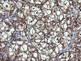 Monoclonal Mouse anti-Human ACAA2 Antibody (clone OTI2F6, IHC, IF, WB)