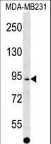 ALS2CL Antibody (aa349-377)