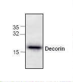 IHC-plus™ Polyclonal Rabbit anti-Human DCN / Decorin Antibody (IHC, WB)