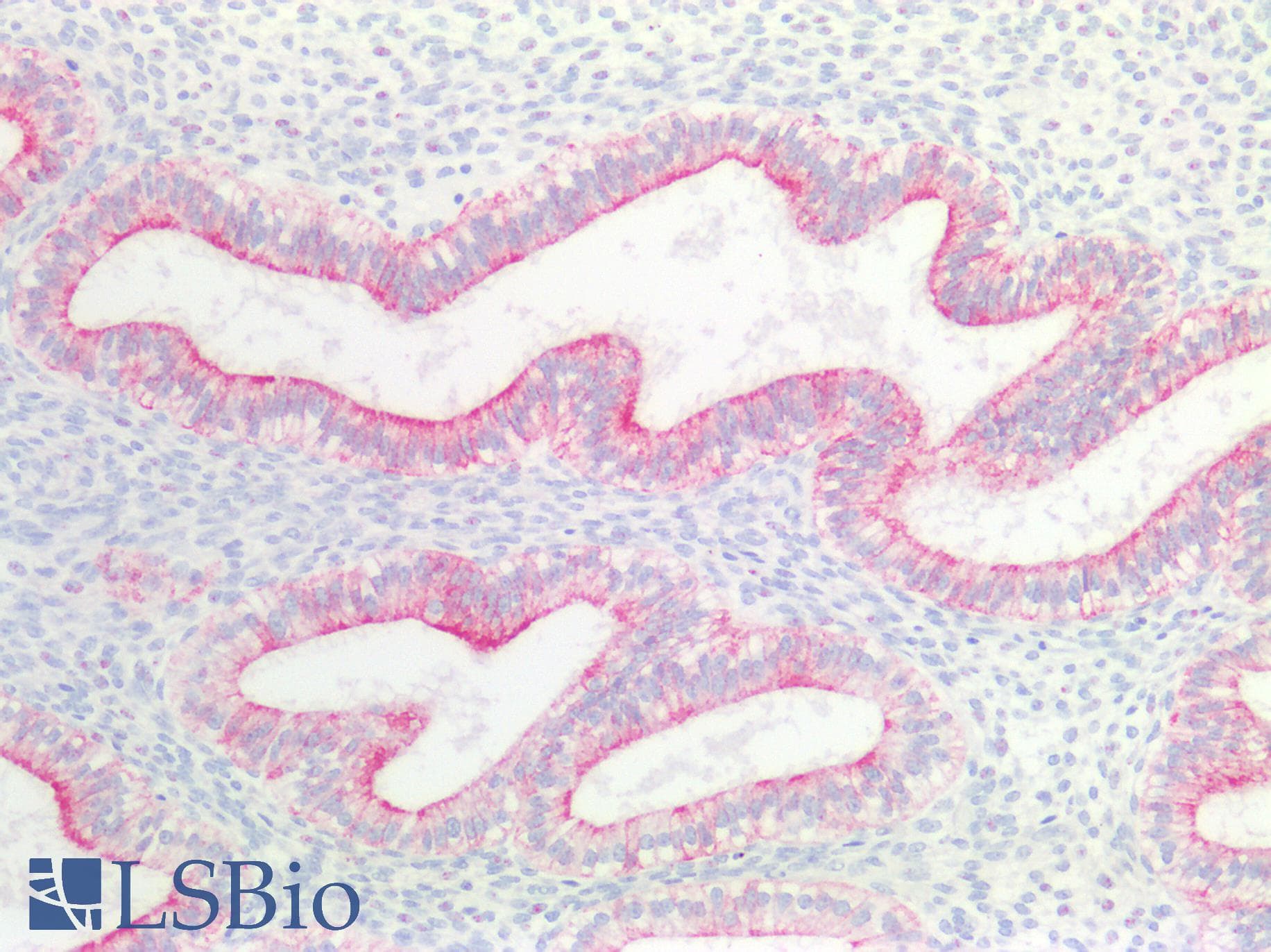PathPlus™ Cytokeratin 4+5+6+8+10+13+18 Antibody (clone C11)