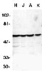 CASP10 / Caspase 10 Antibody