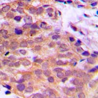 Polyclonal Rabbit anti-Human YWHAQ / 14-3-3 Theta Antibody (C-Terminus, IHC, IF, WB)