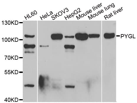 Polyclonal Rabbit anti-Human PYGL Antibody (IHC, IF, WB)