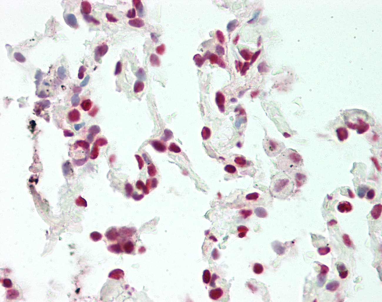 IHC-plus™ Polyclonal Rabbit anti-Human HMG1 / HMGB1 Antibody (IHC, IF, WB)