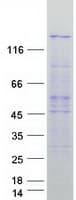 Human PPP4R1 / PP4R1 Protein (Recombinant Myc-DDK (Flag))