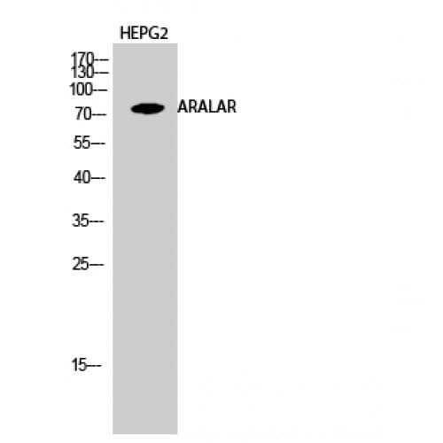 Polyclonal Rabbit anti-Human SLC25A12 / ARALAR Antibody (360-440 aa, Internal, IHC, WB)