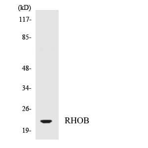 Polyclonal Rabbit anti-Human RHOB Antibody (aa82-131, WB)