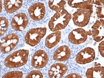 KRT20 / CK20 / Cytokeratin 20 Antibody (clone KRT20/1991)