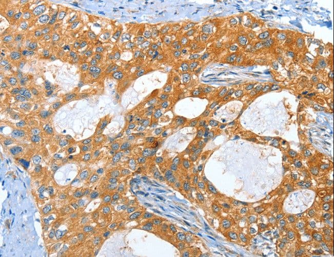 AMHR2 / MISRII Antibody