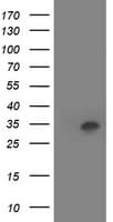 Monoclonal Mouse anti-Human HOXC11 Antibody (clone OTI3G5, IF, WB)