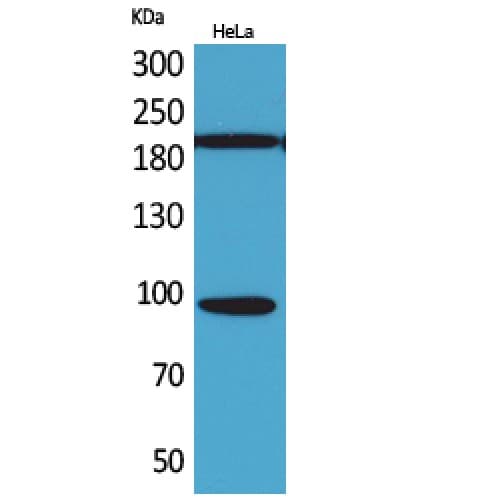 Polyclonal Rabbit anti-Human NTRK3 / TRKC Antibody (271-320 aa, Internal, WB)
