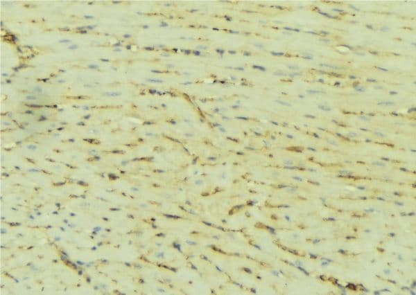 Polyclonal Rabbit anti-Human ATP2A2 / SERCA2 Antibody (IHC, WB)