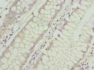 ASB7 Antibody