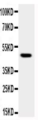MAPK8 / JNK1 Antibody (aa1-15)