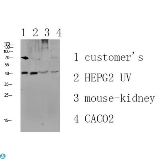 CCR5 Antibody
