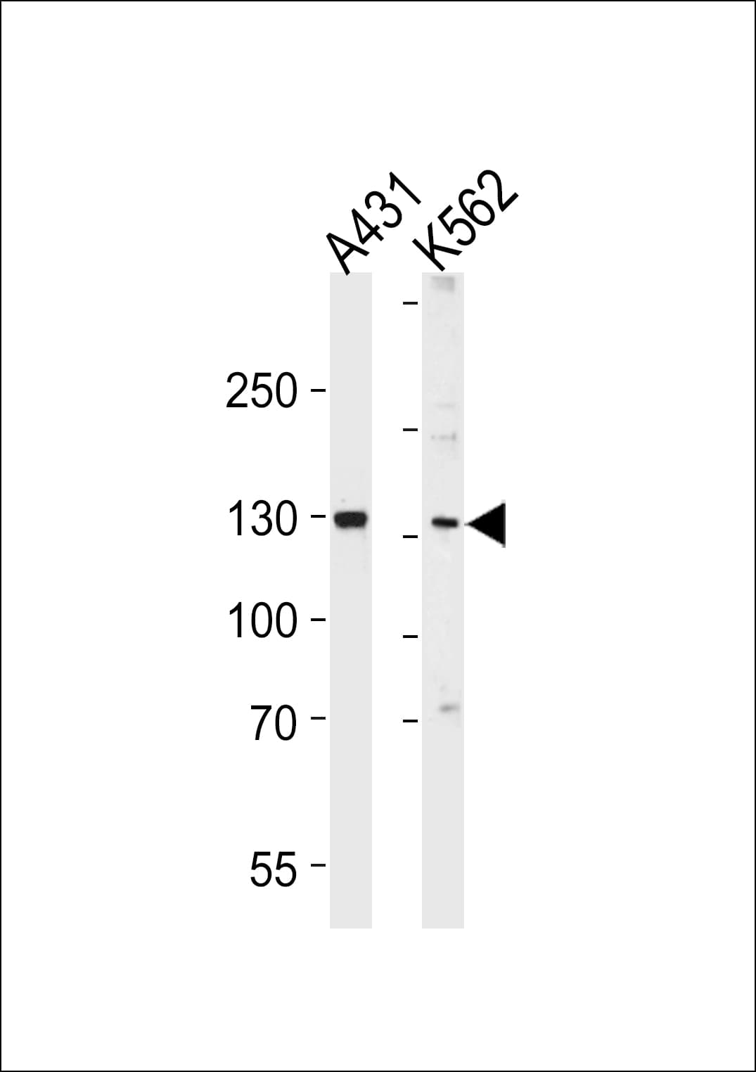 GALNT5 Antibody (aa24-53)