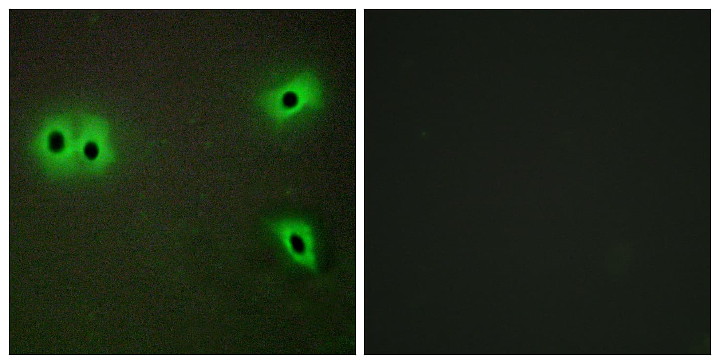 Polyclonal Rabbit anti-Human COL13A1 / Collagen XIII Antibody (aa641-690, IF)