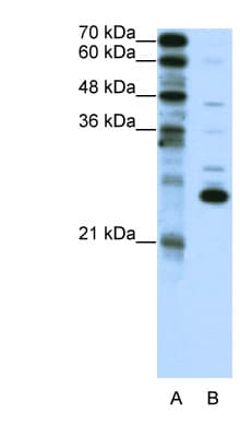 Polyclonal Rabbit anti-Human Recoverin Antibody (aa131-180, IHC, WB)