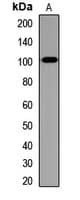 SULF2 / Sulfatase 2 Antibody