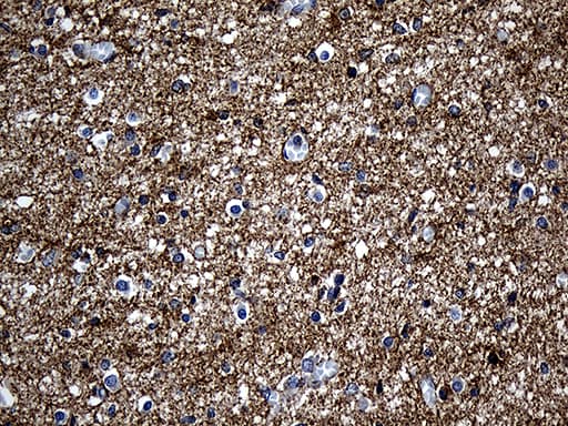 SEPT3 / Septin 3 Antibody (clone OTI3F4)